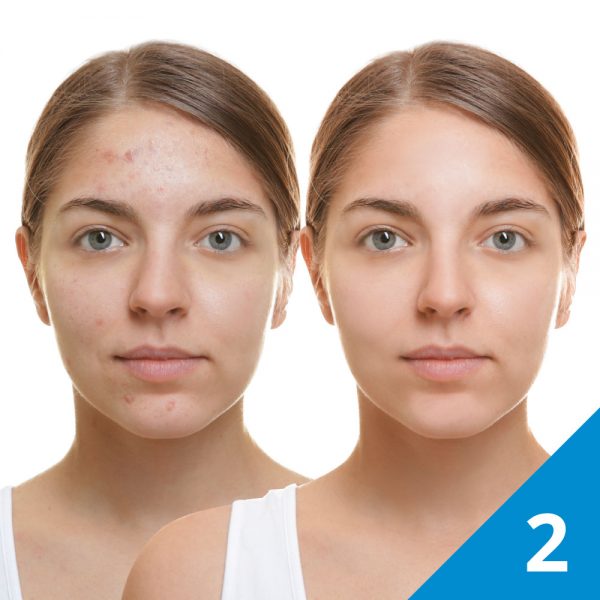 Module 2 : Most Common Skin Diseases