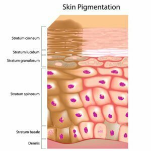 L’hyperpigmentation, pas que des taches !