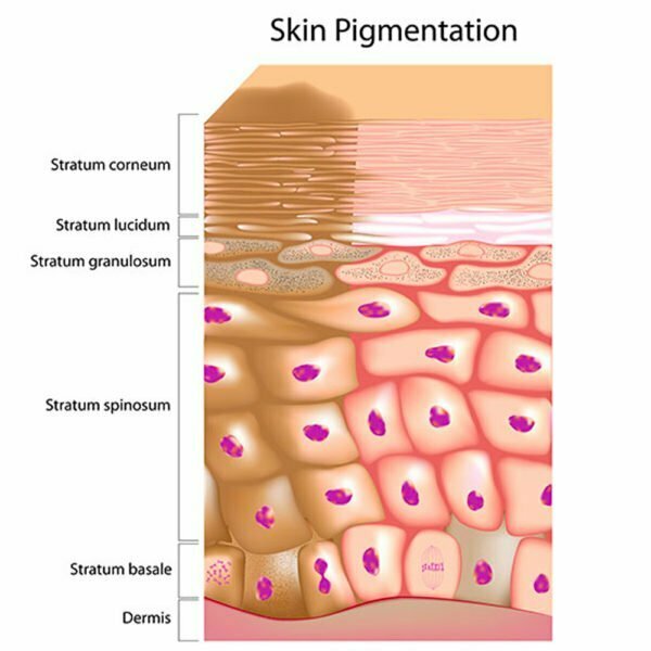 L’hyperpigmentation, pas que des taches !