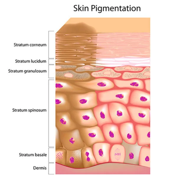 L’hyperpigmentation, pas que des taches !